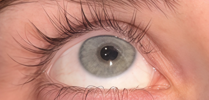 Lash results